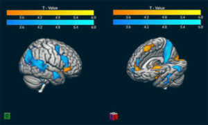 Neuroscientists Analyze Brain Scans Of Soccer Fans To Research Passionate