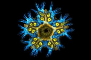 Starfish Possess Only A Substantial, Compressed Head And Lack A