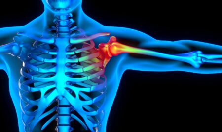 Ineffective Common Shoulder Treatments Identified