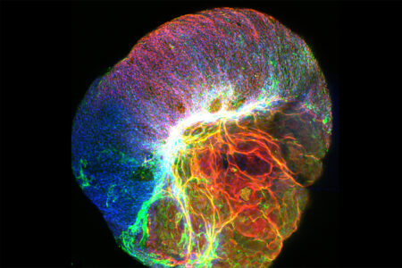 Top 10 Groundbreaking Medical Advancements: Pure Moments of Eureka captured in Photos Top 10 Groundbreaking Medical Advancements: Pure Moments Of Eureka Captured