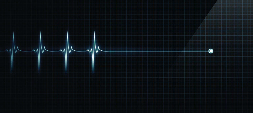 Understanding the sensation of dying: Insights from medical professionals Understanding The Sensation Of Dying: Insights From Medical Professionals