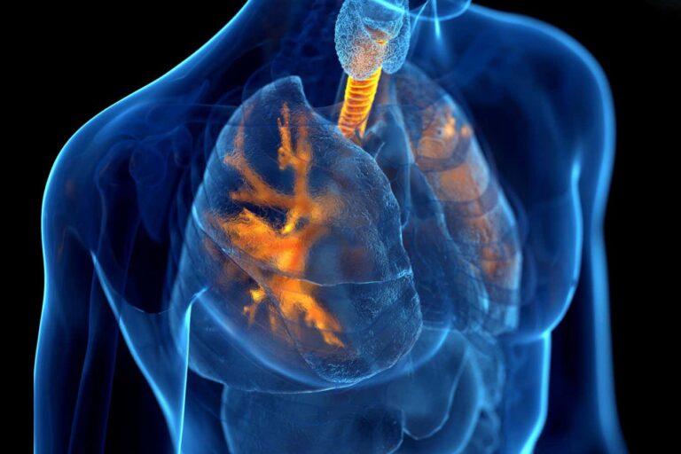 Using Inhalable Nanoparticles to Treat COPD, a Chronic Lung Disease Using Inhalable Nanoparticles To Treat Copd, A Chronic Lung Disease