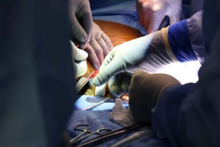 First Ever Pig Kidney Transplant Performed On A Living Human