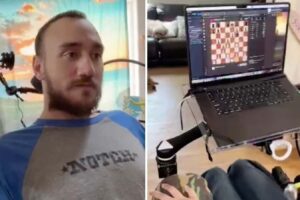 Neuralink Question: Has Elon Musk Achieved A Revolutionary Advance In