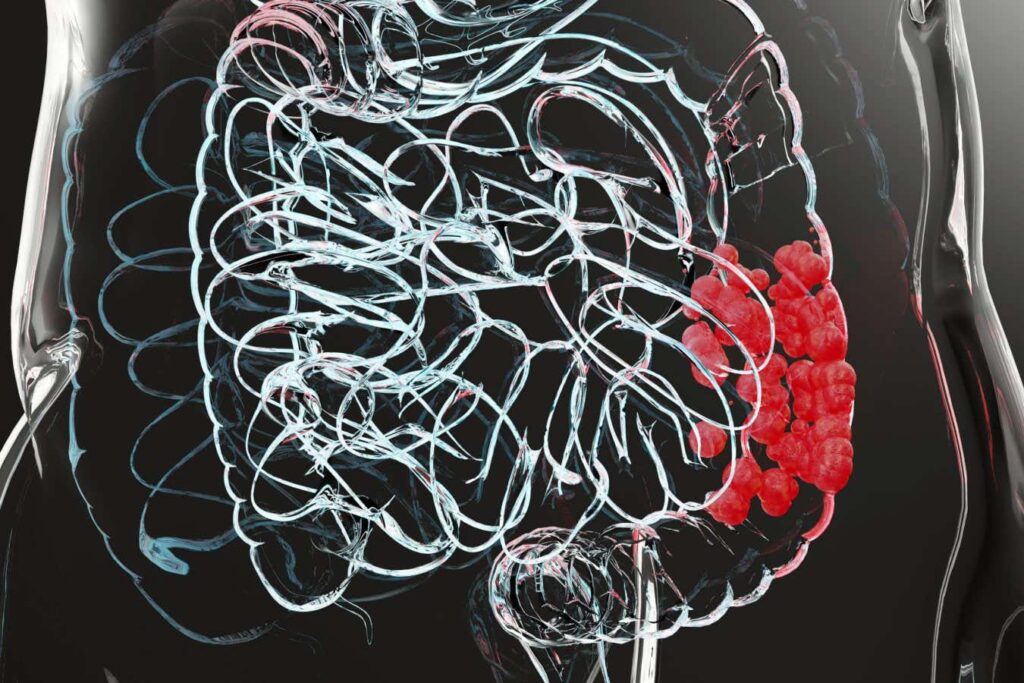 Ongoing investigations to determine the reasons behind the rise of colorectal cancer in young individuals. Ongoing Investigations To Determine The Reasons Behind The Rise Of
