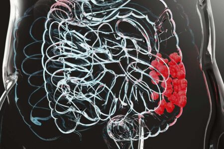 Ongoing Investigations To Determine The Reasons Behind The Rise Of