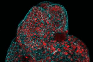 Uterine Fluid Based Organoids Show Promise For Treating Unborn Fetuses