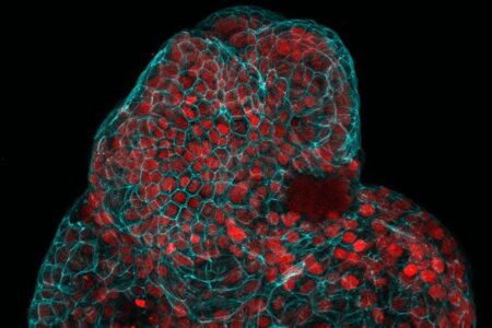 Uterine fluid-based organoids show promise for treating unborn fetuses Uterine Fluid Based Organoids Show Promise For Treating Unborn Fetuses