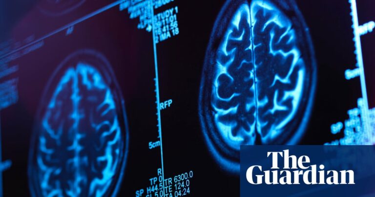 Research Suggests Smartphone App Could Aid In Early Diagnosis Of