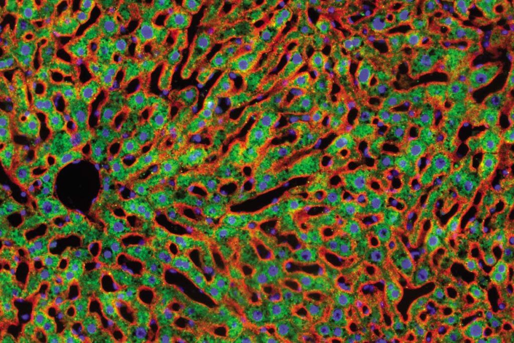 Anti Inflammatory Medication Increases Mice's Lifespan By 20%