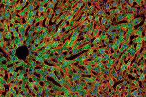 Anti Inflammatory Medication Increases Mice's Lifespan By 20%