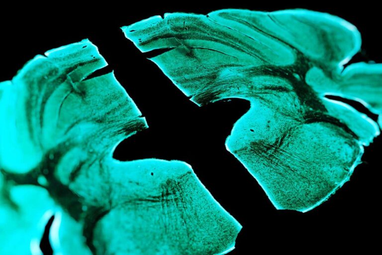 Potential Discovery: Understanding How the Placebo Effect Alleviates Pain Potential Discovery: Understanding How The Placebo Effect Alleviates Pain
