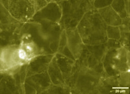 Two Antibiotics Found In Arctic Marine Bacteria By Scientists