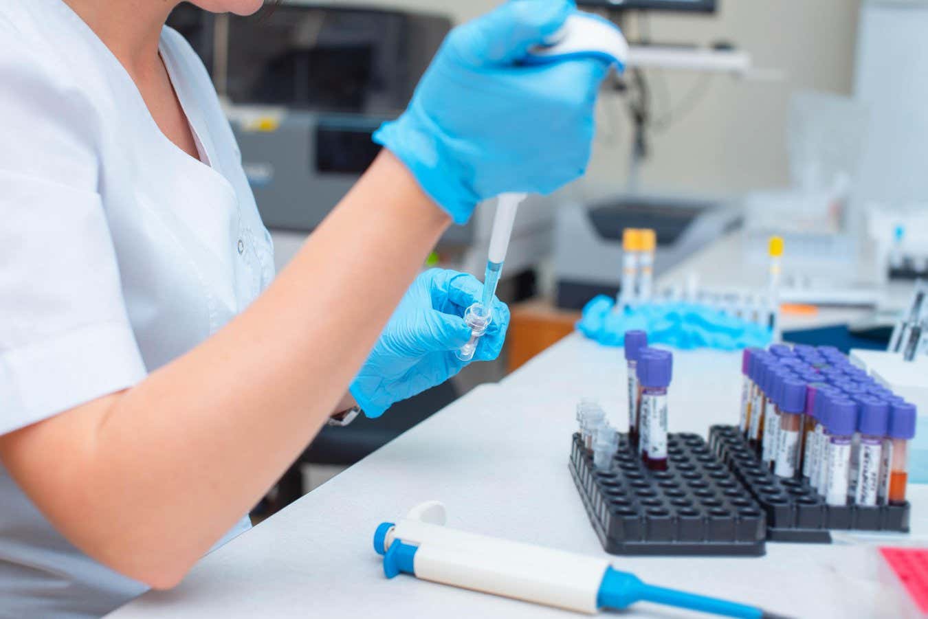 Blood Test Accurately Detects Als In 97% Of Cases