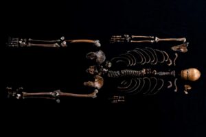 Dna Analysis Confirms The Identity Of 'wellman' Skeleton With An