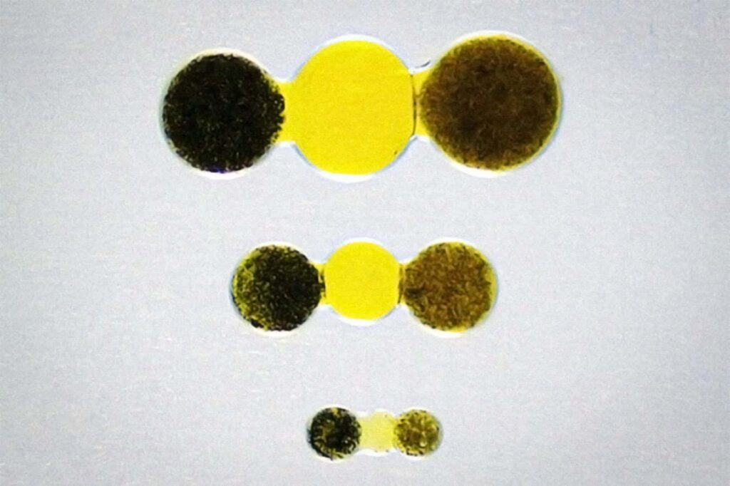 Silk Hydrogel Battery Could Power Pacemakers In Mice