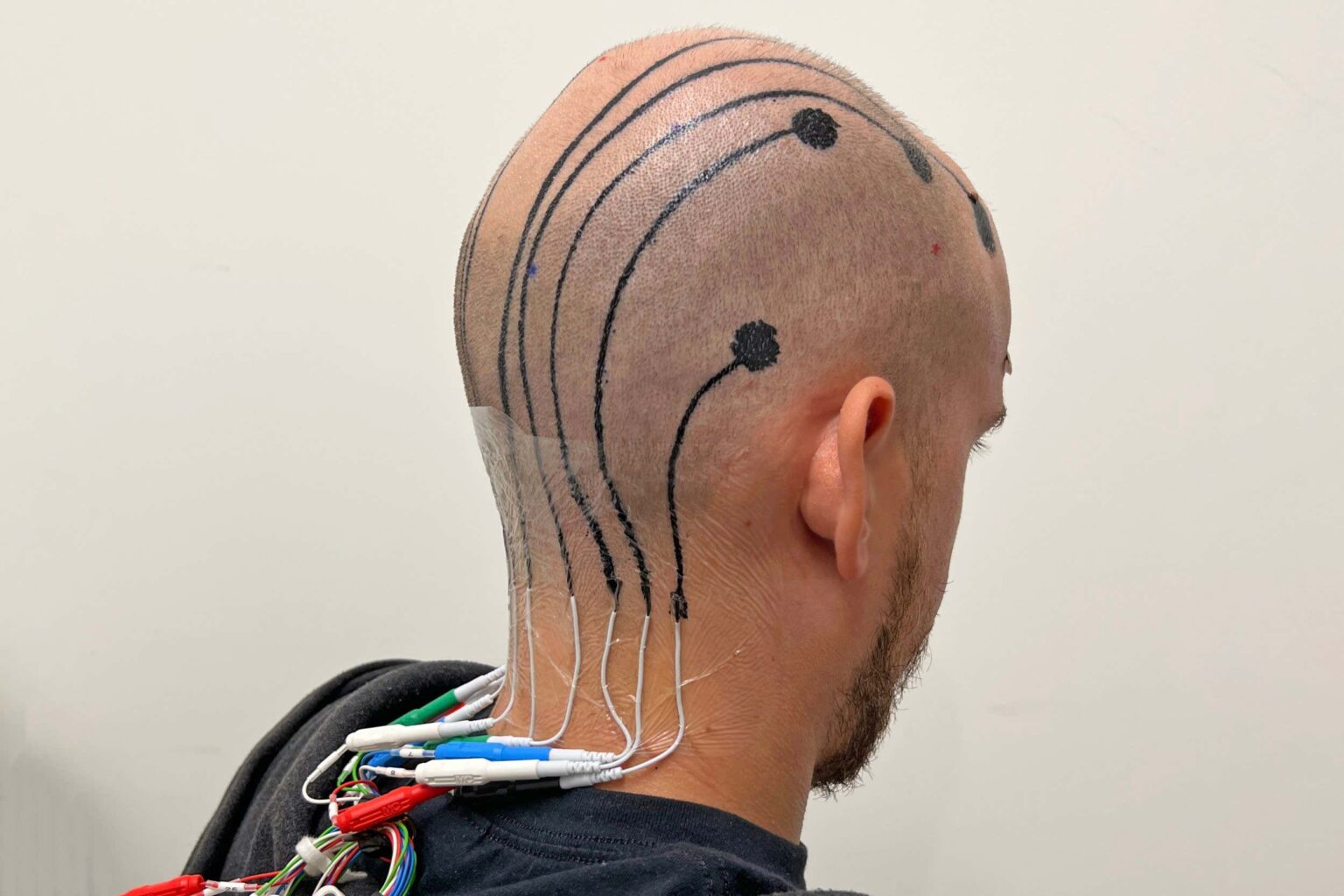 Scalp tattoos can temporarily record brain activity Scalp Tattoos Can Temporarily Record Brain Activity