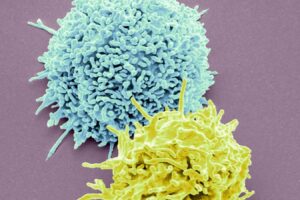 New Therapies On The Horizon To Combat Autoimmune Diseases