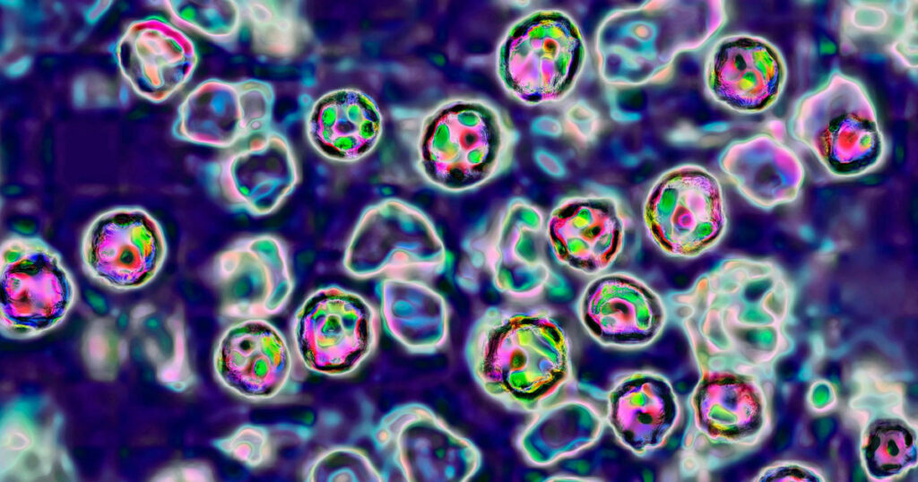 Potential long-term consequences of measles: immune system memory loss and encephalitis Potential long term consequences of measles: immune system memory loss and