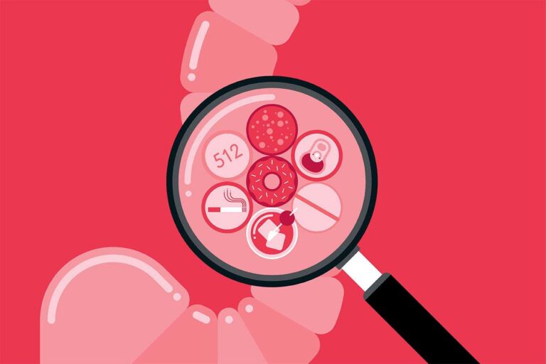 Surprising increase in colorectal cancer diagnoses among individuals under 50 Surprising increase in colorectal cancer diagnoses among individuals under 50