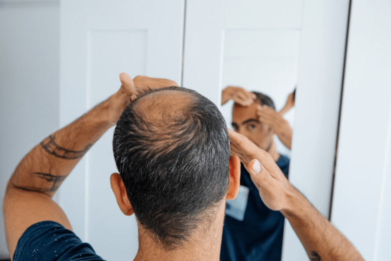 Balge's end: the secret to hair regeneration unveiled