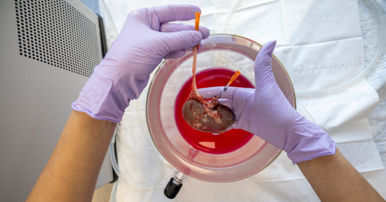 Can a surgeon successfully implant a kidney frozen for 10
