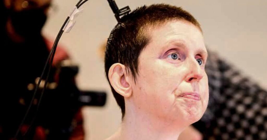 Experimental brain computer implant restores speech for stroke survivors