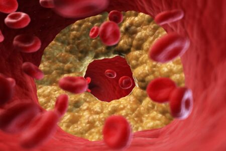 The impact of different coffee types on cholesterol levels