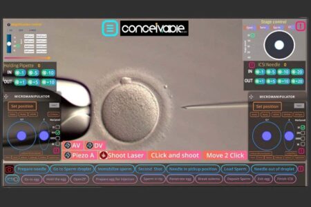 The world’s first IVF baby was born with very little human intervention The world's first ivf baby was born with very little