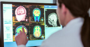 Canada's enigmatic brain disease: the mystery unveiled