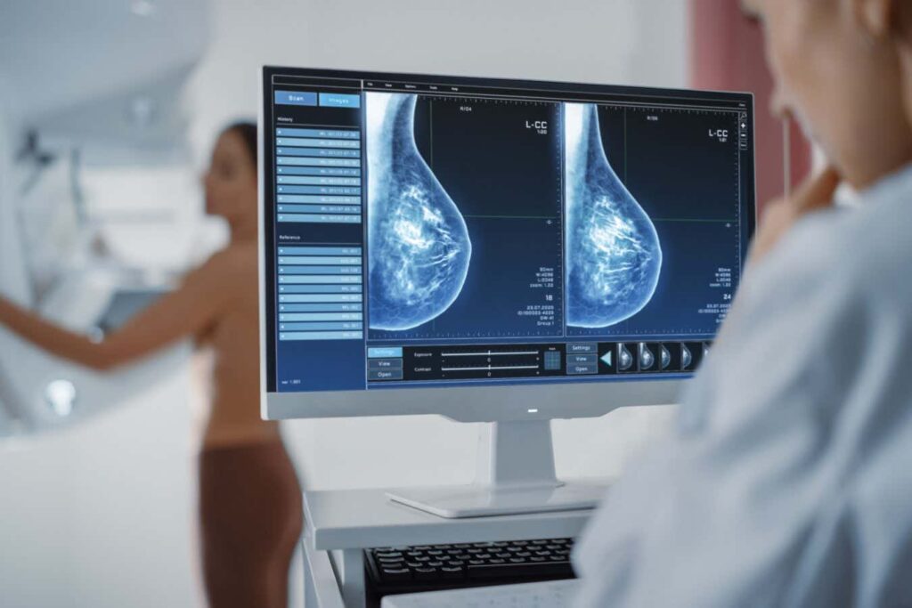 Enhanced Cancer Screening Could Detect Early Cases in Women with Dense Breasts Enhanced cancer screening could detect early cases in women with
