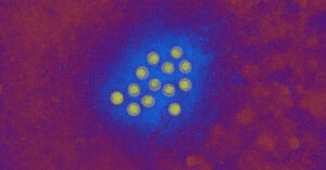 Essential information on the hepatitis a outbreak in la county