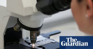 New ai tools predict which men will respond to prostate