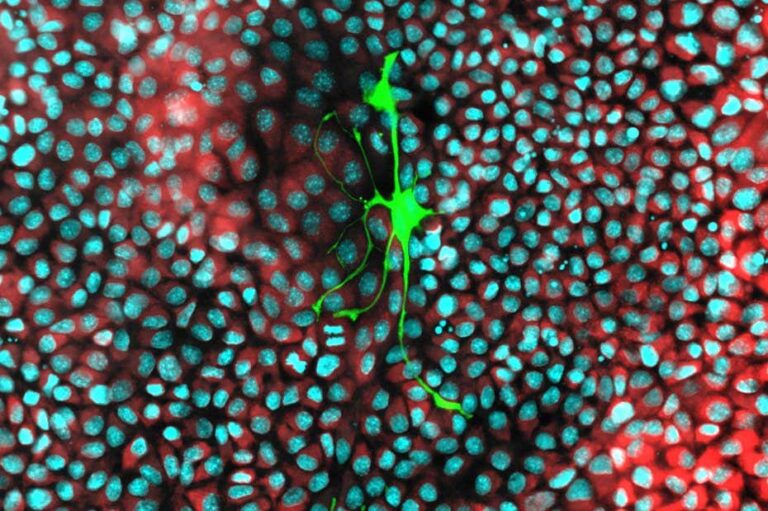 Cancer Cells Hijack Mitochondria from Neurons to Fuel Their Growth
