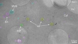 Discovery of Hemifusomes Biologists Unveil New Organelle Complexes in Human