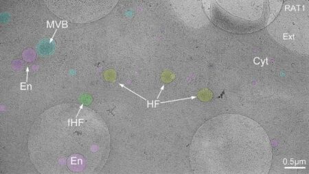 Discovery of Hemifusomes Biologists Unveil New Organelle Complexes in Human