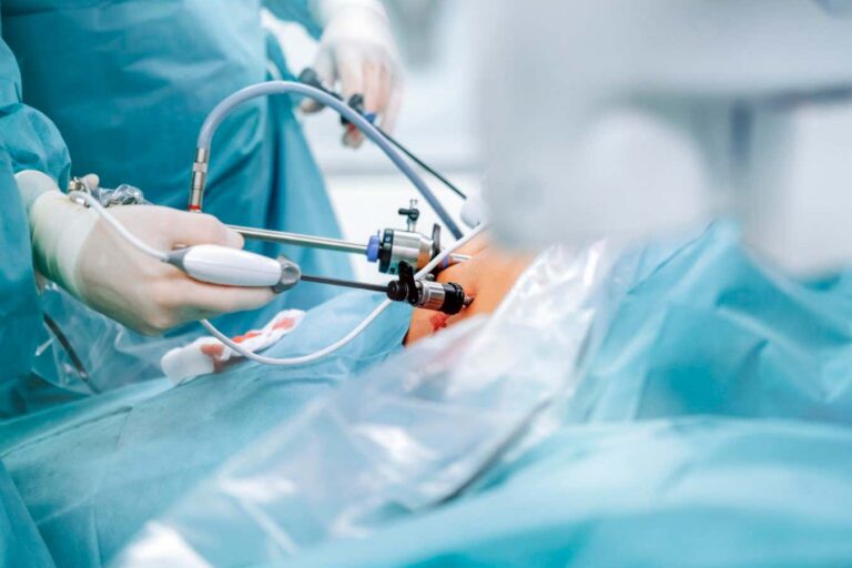 Gastric Bypass Surgery Potentially Lowers Intestinal Cancer Risk Gastric Bypass Surgery Potentially Lowers Intestinal Cancer Risk