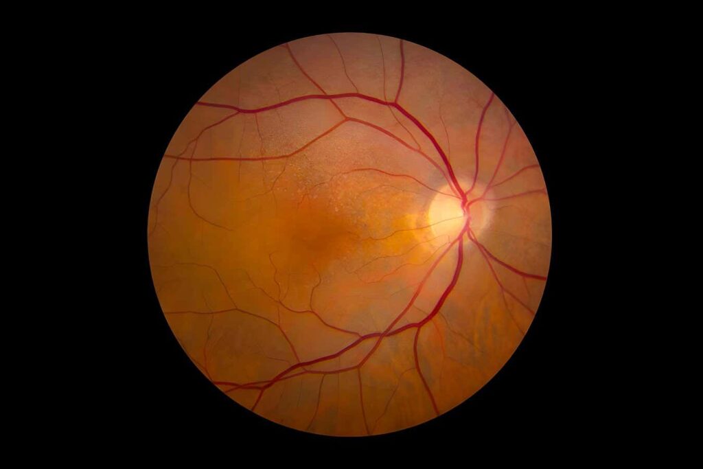 Retinal implants regain vision in blind mice