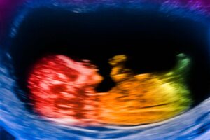 The Evolution of Our Large Brains The Role of Placental