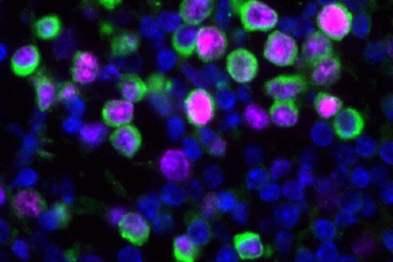 COVID-19 and Flu Could Reactivate Dormant Lung Cancer Cells COVID 19 and Flu Could Reactivate Dormant Lung Cancer Cells
