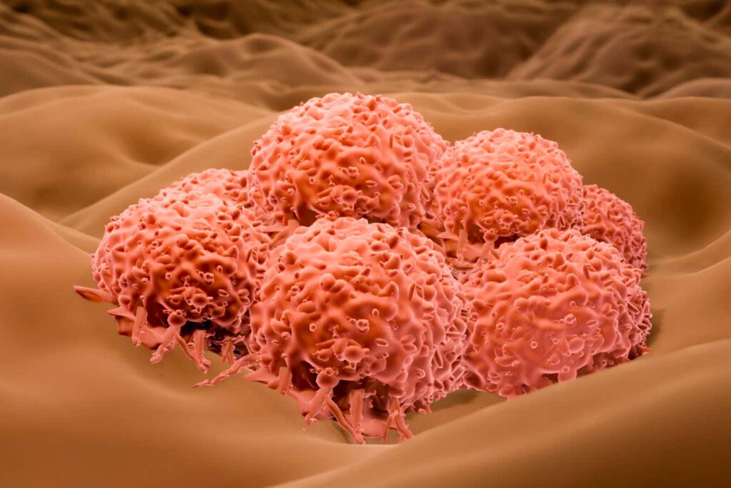 Herpes Virus Could Be Fast Tracked for Treating Severe Skin Cancer