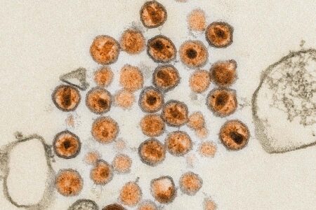 Human Trials Illuminate Pathway for mRNA Vaccines Targeting HIV