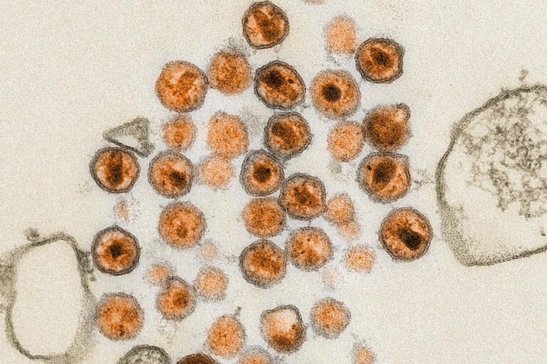 Human Trials Illuminate Pathway for mRNA Vaccines Targeting HIV Human Trials Illuminate Pathway for mRNA Vaccines Targeting HIV