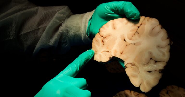 What to Know About CTE Following NYC Shooting Suspects Possible