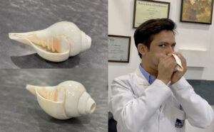 Ancient Conch Shell Blowing May Benefit Those with Obstructive Sleep