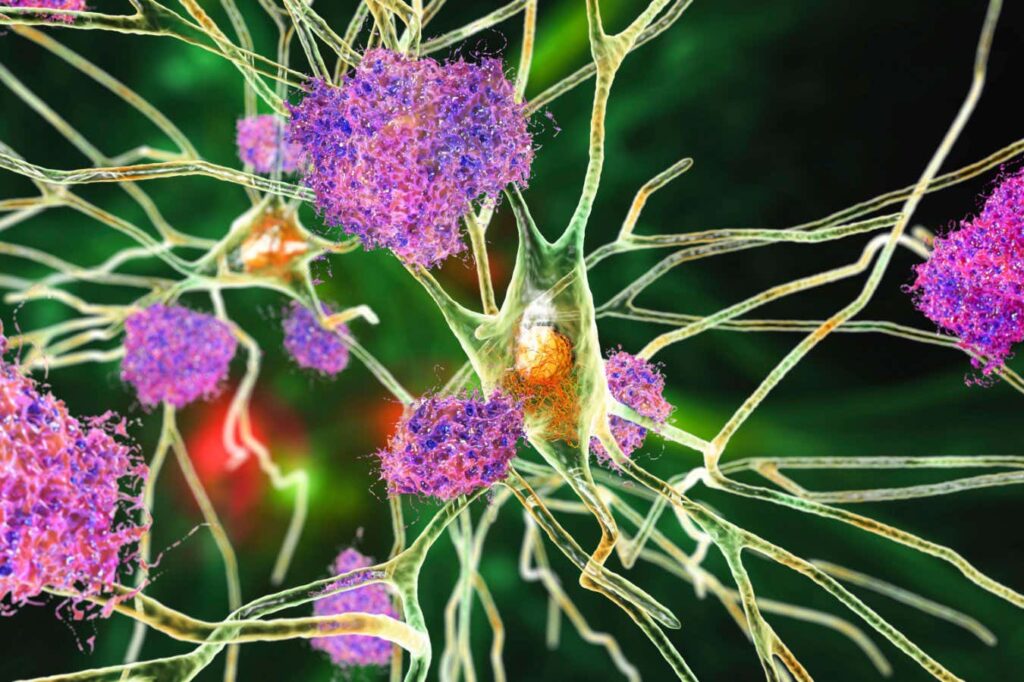 Low Dose Lithium Alleviates Alzheimers Symptoms in Mice