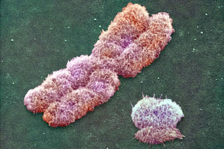 The Vanishing Y Chromosome: A Potential Contributor to Heart Disease in Men The Vanishing Y Chromosome A Potential Contributor to Heart Disease