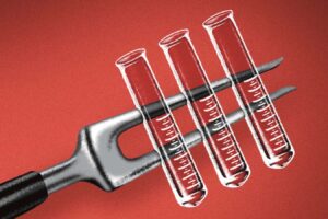 Why Are We Drawn to Fake Lips but Reluctant About