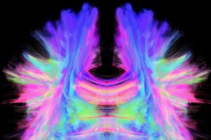 Brain Structure Mapping Alone Fails to Capture Its Functionality