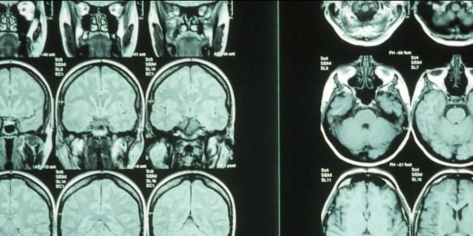 1756952460802 now staytuned thumbs brain 250903 1920x1080 pohbkl